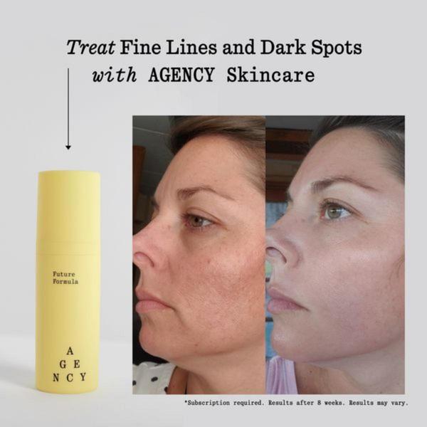 skincare serum, face serum, anti-aging serum, skin treatment, facial serum, beauty serum, skincare product, social proof, ugc style, trustworthy, neutral, yellow