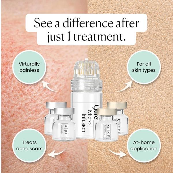 skincare treatment, acne treatment, micro infusion, facial serum, skin care device, beauty treatment, cosmetic treatment, product launch, brand awareness, minimalist, trustworthy, fresh, neutral, pastel