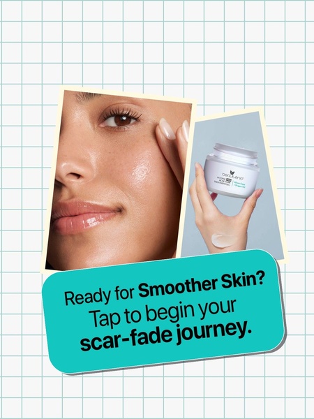 skincare cream, face cream, moisturizer, anti-aging cream, scar treatment, facial treatment, skin cream, product launch, modern typography, fresh, trustworthy, green, neutral