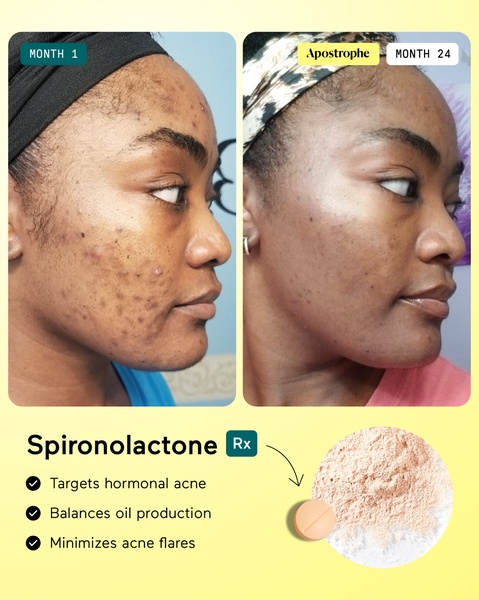 acne treatment, skin care, hormonal acne, acne medication, skincare product, dermatology treatment, prescription acne, social proof, ugc style, trustworthy, yellow, blue
