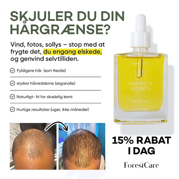 A square ad creative featuring a hair growth oil bottle next to a comparison image showing scalp density improvement, with a clear 15% discount offer.