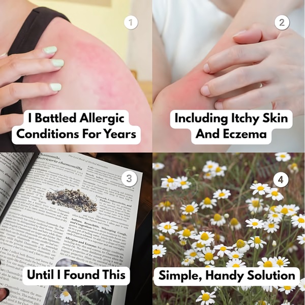 skin care, eczema treatment, allergy relief, skin remedy, dermatitis care, natural skincare, skin solution, social proof, product launch, ugc style, trustworthy, warm, neutral, yellow
