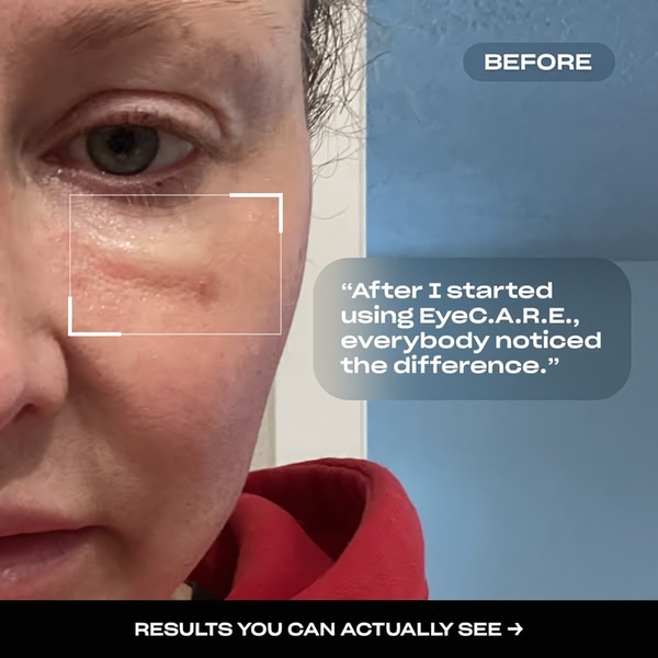 eye cream, eye serum, under eye treatment, eye care, anti aging cream, skincare product, wrinkle cream, social proof, product launch, ugc style, trustworthy, blue, neutral