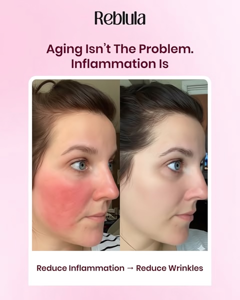 anti-aging cream, skincare serum, wrinkle treatment, face moisturizer, anti-inflammatory skincare, aging skincare, facial treatment, social proof, brand awareness, ugc style, trustworthy, pink, neutral