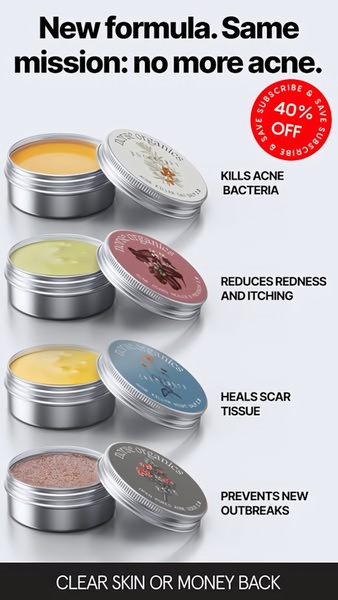 acne treatment, skincare balm, acne cream, skin treatment, face balm, acne care, skincare product, product launch, sale promotion, minimalist, trustworthy, fresh, neutral, red