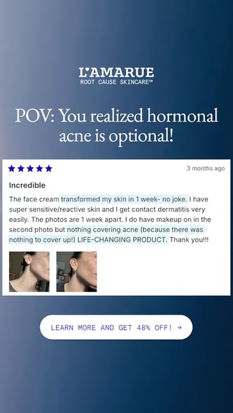 face cream, skincare cream, facial moisturizer, acne treatment, skin cream, anti-acne cream, hormonal acne cream, social proof, sale promotion, ugc style, trustworthy, blue