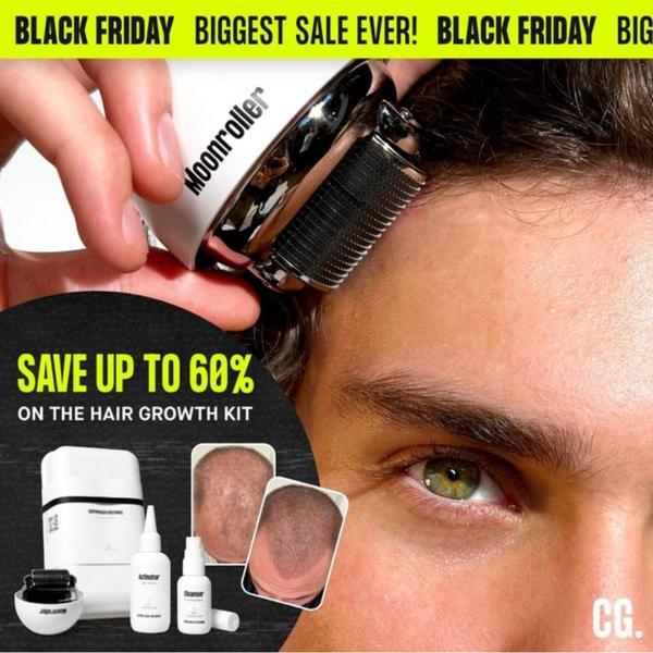 A 1:1 square ad creative featuring a close-up of a derma roller application and side-by-side hair regrowth progress photos, anchored by a clear Black Friday discount banner.