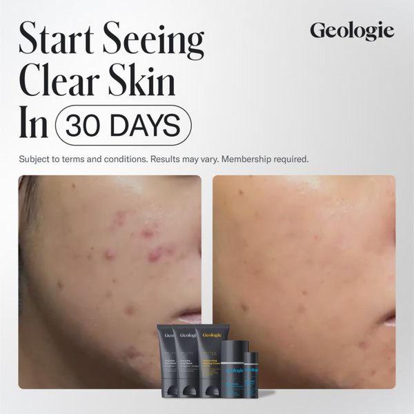 skincare products, face care, acne treatment, skin treatment, beauty products, facial care, cosmetics, brand awareness, minimalist, trustworthy, neutral