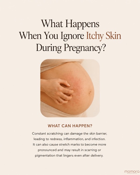 A high-contrast informational graphic that uses a medical-style educational hook to address common pregnancy skin concerns and encourage product usage.