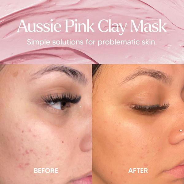 clay mask, face mask, skincare mask, facial treatment, pink clay mask, pore mask, acne mask, social proof, ugc style, trustworthy, warm, pink, neutral