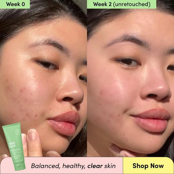 face cleanser, facial cleanser, oil control cleanser, acne cleanser, skincare cleanser, face wash, cleansing gel, social proof, ugc style, trustworthy, fresh, green, neutral