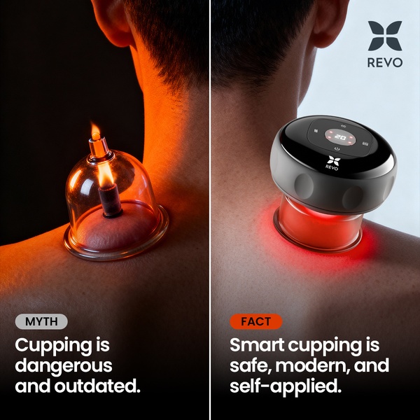 Smart Cupping Myth vs. Fact Comparison