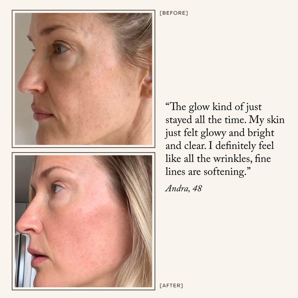 anti aging serum, face cream, skincare treatment, wrinkle cream, skin brightening serum, customer review, ugc style, trustworthy, fresh, neutral