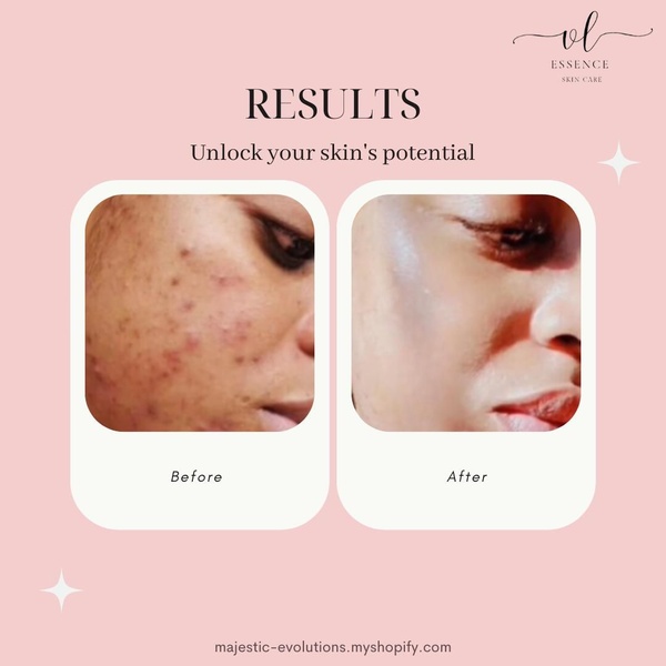 This ad features a side-by-side comparison of a user's skin condition before and after using a skincare treatment to demonstrate product efficacy.