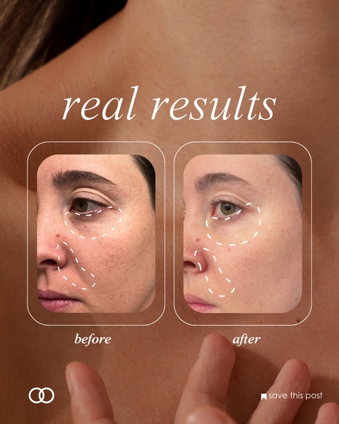 skin care, face serum, skin treatment, facial cream, anti aging skincare, dark spot treatment, social proof, brand awareness, ugc style, editorial, trustworthy, warm, brown, neutral