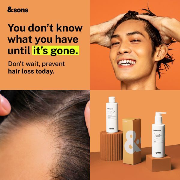 A square ad featuring a man applying hair treatment, a close-up of a receding hairline, and the product bottles, utilizing high-contrast orange branding.